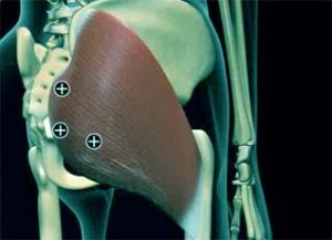 Betennelse i lårbenet eller trochanteritt i hofteleddet