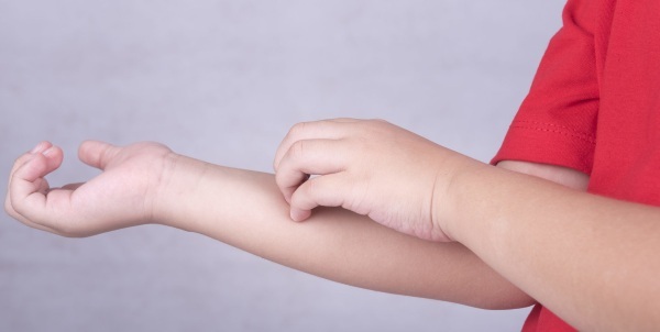 Scabies in children. Treatment, drugs, folk remedies, what is it, prevention