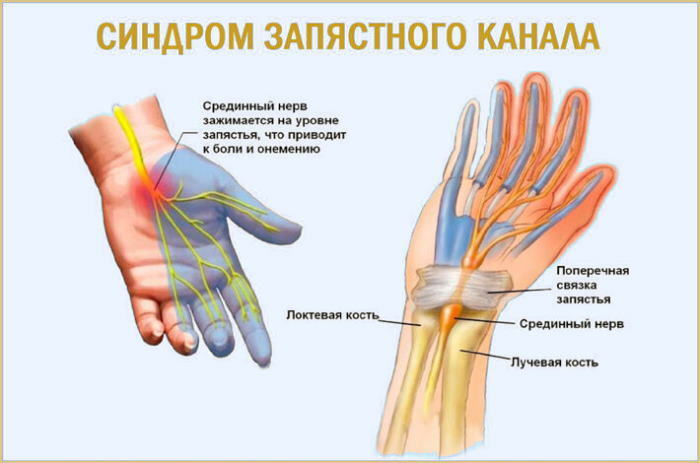 Hands and feet go numb and goosebumps run. Causes and treatment