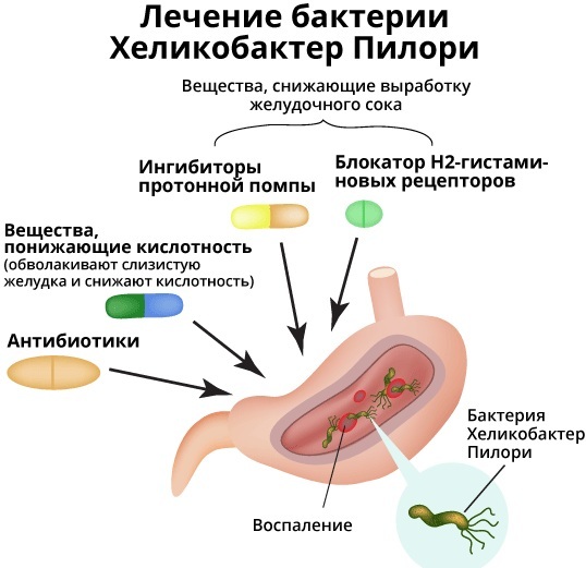 Treatment of gastritis with Helicobacter pylori. Scheme, folk remedies, medicines, reviews