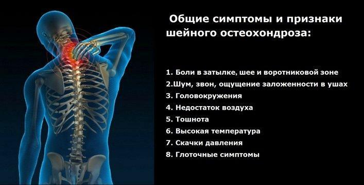 קוצר נשימה עם osteochondrosis: סימפטומים, טיפול, מניעה