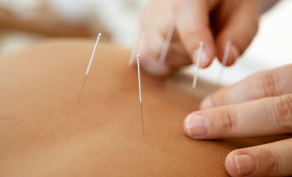 Akupunktur. Indikationer og kontraindikationer