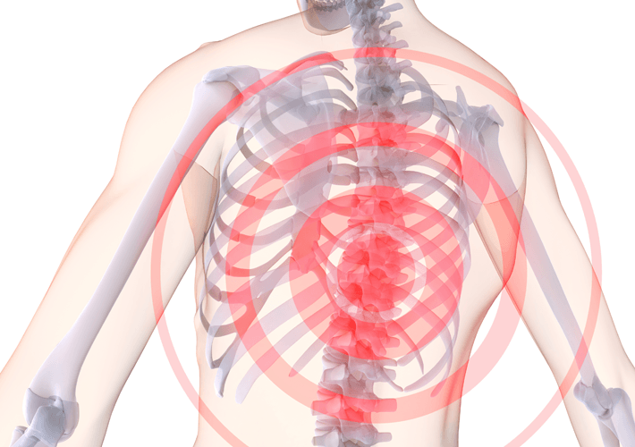 Osteochondroza klatki piersiowej: objawy