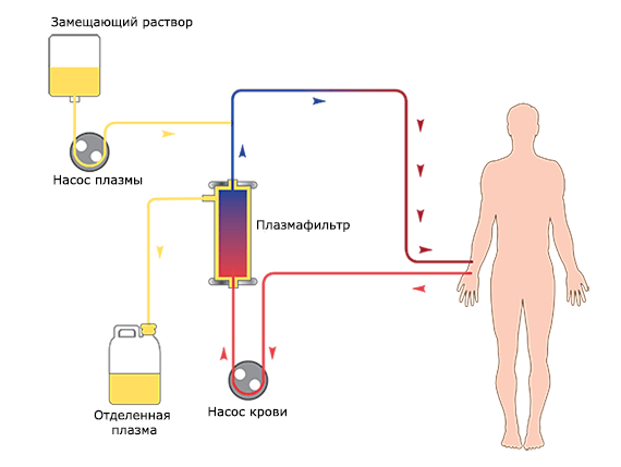 Plasmapherese-Prozess
