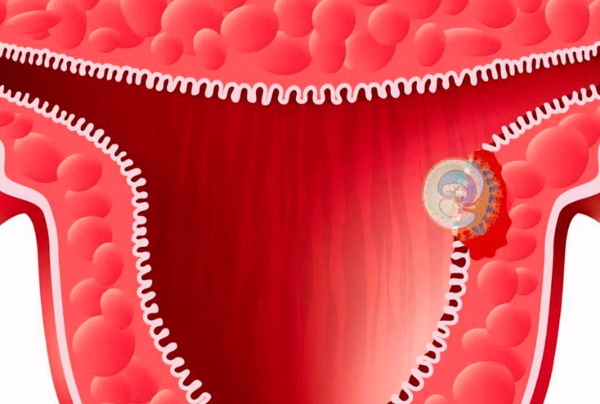 Faze razvoja človeškega zarodka po tednih. Fotografija