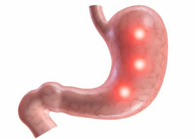 Papillitis of the stomach: what is it?
