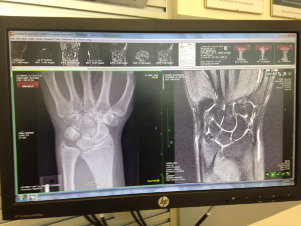 A kéz MRI -je. Mi mutatja, hogyan történik, ár, előkészítés