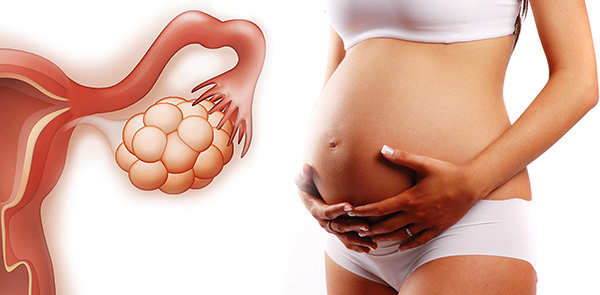 Jak léčit onemocnění polycystických vaječníků a otěhotnět bez hormonů. Léky