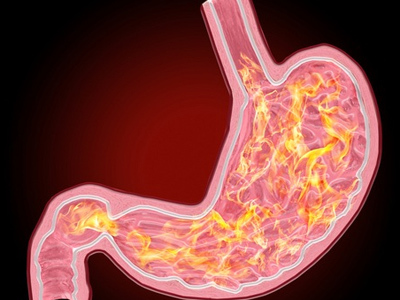 Gastrin: nedir, hormonun vücuttaki işlevleri