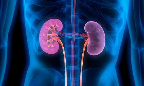 Causes and clinical picture of kidney hydrocalysis