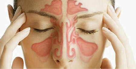 Przyczyny alergicznego nieżytu nosa, fot