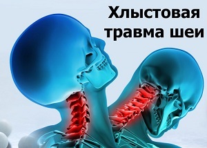 whiplash injury of the neck