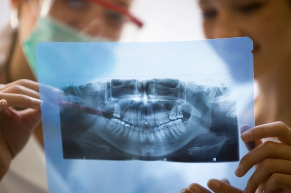 Hundi suu lastel. Fotod enne ja pärast operatsiooni, välimuse põhjused, ravi