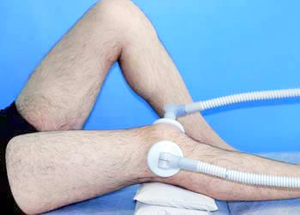 Liečba bursitídy kolena