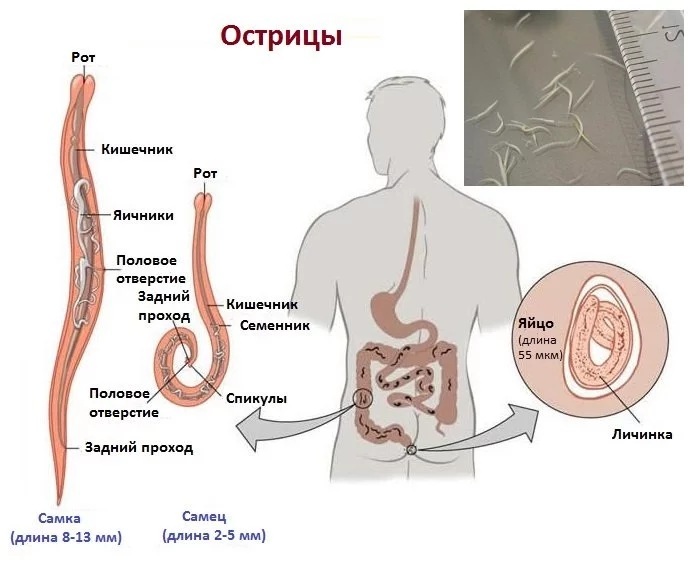 Откуда берутся черви. Паразиты в организме человека острицы. Гельминты энтеробиоз у детей. Строение червя Острица.