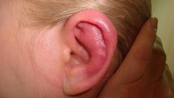 Małżowina uszna. Anatomia, budowa ucha środkowego, zewnętrznego, wewnętrznego, funkcje
