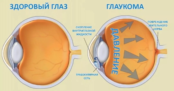 Ocumetované oční kapky. Návod k použití, cena, recenze