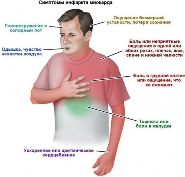 Infarto de miocardio: qué hacer, primeros auxilios.