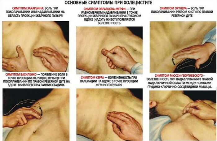 Tekenen van ontsteking van de alvleesklier bij een vrouw, symptomen