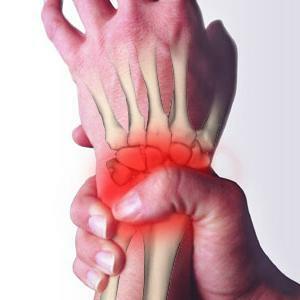Pain syndrome in the hand