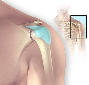 Een visueel beeld van de slijmbeursontsteking van de schouder