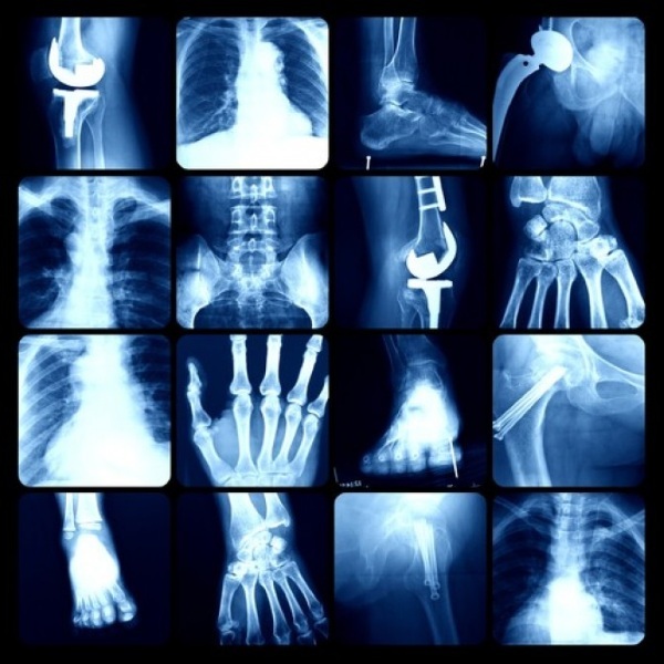 Ortopeed-traumatoloog. Mis ravib, mida teeb laps, täiskasvanu