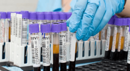 Test de sânge biochimic