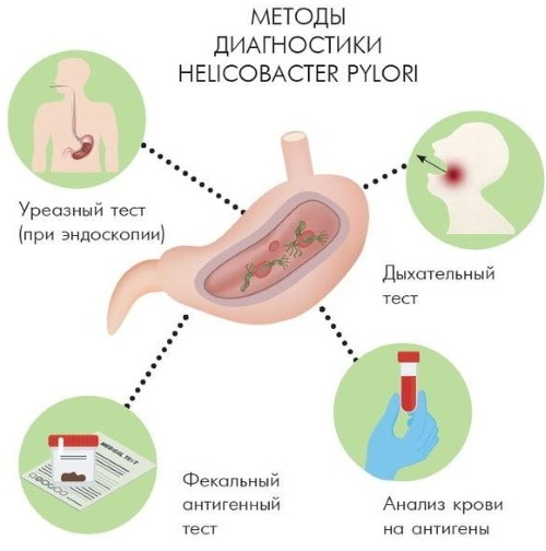 Helicobacter pylori bakterijos skrandyje. Kaip gydyti vaistais