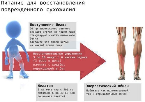 Ligaments and tendons. Strengthening with vitamins, training, drugs, gymnastics