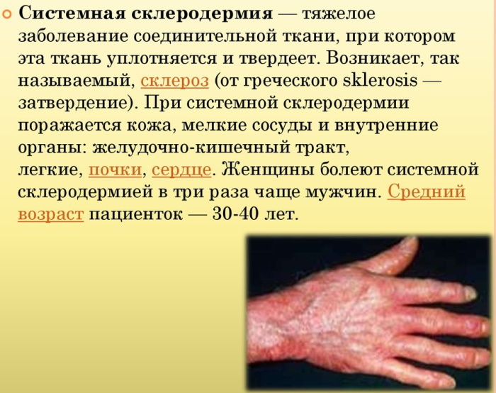 Sensación de hormigueo en las puntas de los dedos de manos y pies. Causas