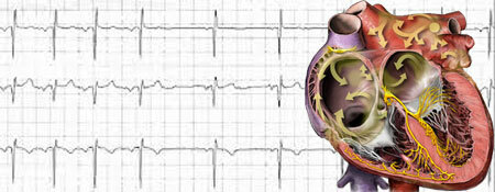 Sinusová arytmie srdce - co to je? Známky, typy, léčba