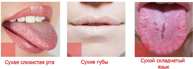Salty taste in mouth and lips. Causes and treatment