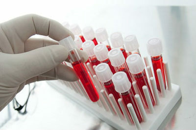 Fracções proteicas( proteinograma) na análise bioquímica de sangue: o que é, decodificação