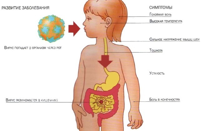 Rotavirusinfektion i ett barn under ett år, 2-7 år, utan feber och diarré. Symptom och behandling