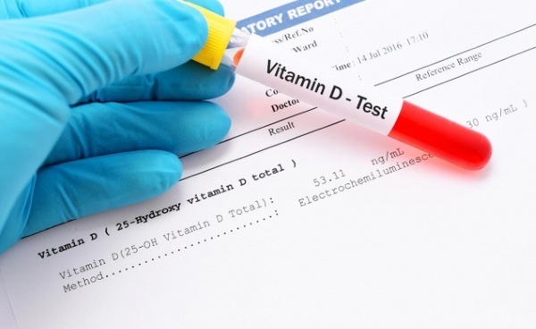 Analyse for D -vitamin Hvordan man lejer, hvad viser, hvad er det til, prisen