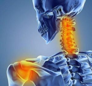 bolesť v oblasti krku a ramena
