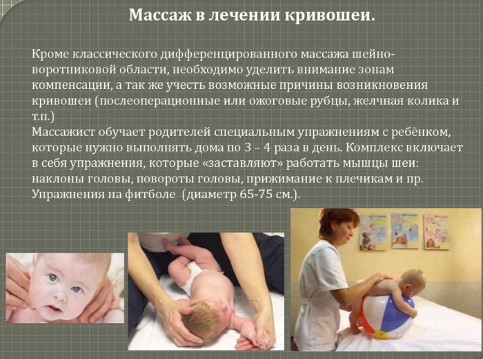 Torticollis em bebês 2-3-4-6 meses. Sintomas, fotos, tratamento