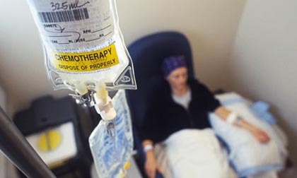 kemoterapi