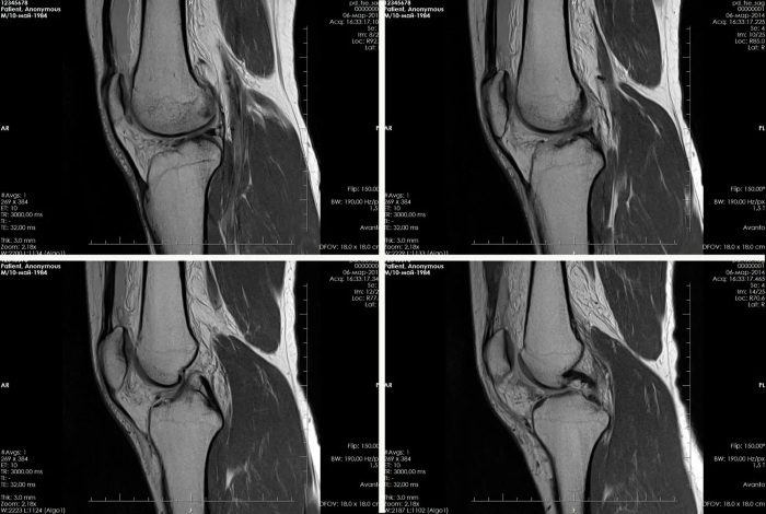 MRI of the knee. Price, which shows how it goes, contraindications, indications, preparation