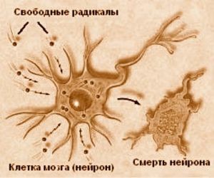 A neuronok halála
