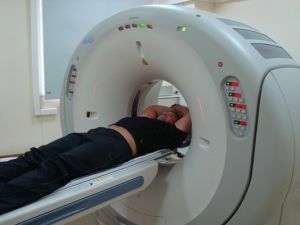MRI van de hersenen