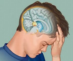 symptoms of pituitary adenoma