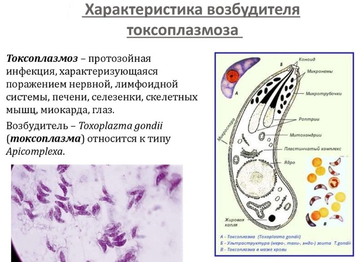 Toxoplasmosis in adults. Symptoms and treatment, drugs, folk remedies. How is diagnostics