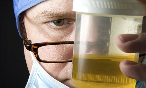 Waarom vertroebelt urine en met wat het kan worden verbonden