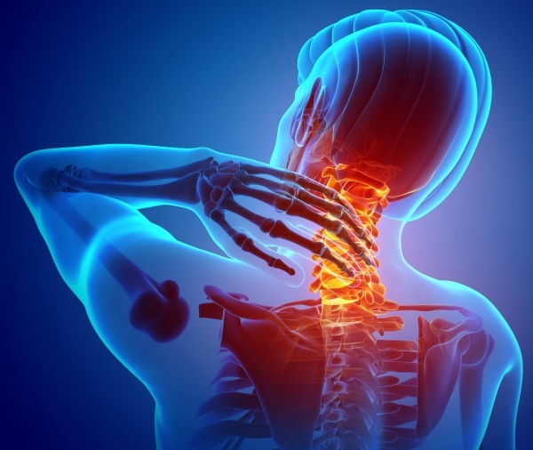 Vertebral cervicalgia. What is it, how to treat with muscle-tonic, myofascial, pain syndrome
