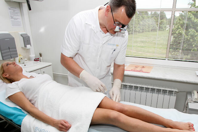 Cirurgia para remover veias nas pernas: preço, formas, conseqüências e reabilitação