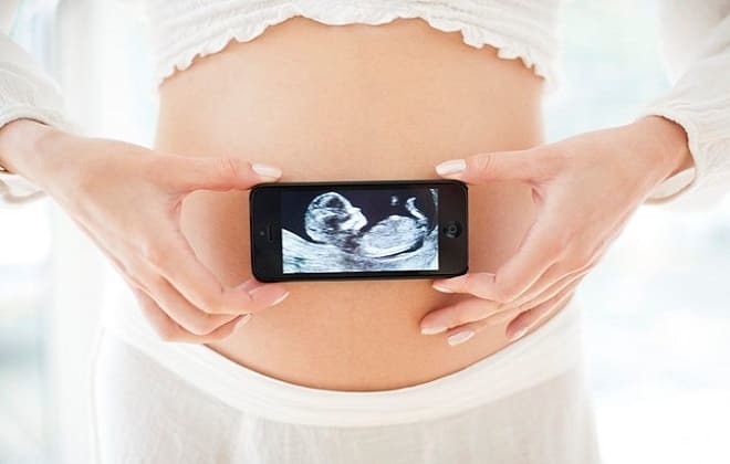 Pregnant with ultrasound image