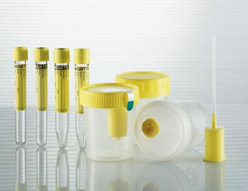 Análise de urina de Sulkovich: como coletar, a norma