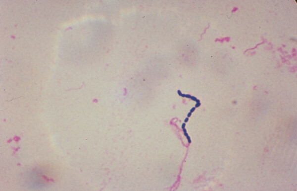 Cocci in a smear in men. What is it, the norm of gram cocci