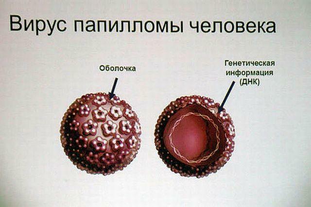 Human papillomavirus